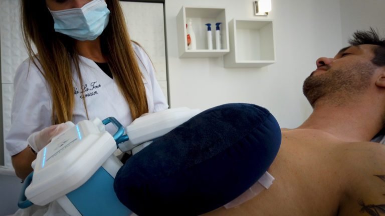 TEST de la Cryolipolyse à Nice (Clinique Villa La Tour)