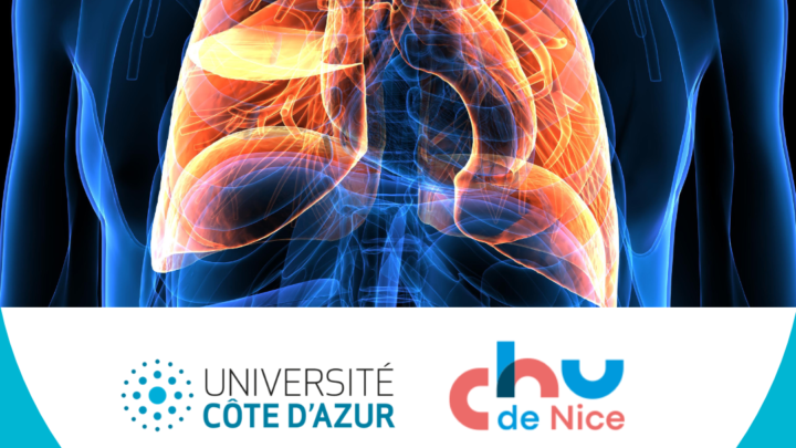 Un nouvel IHU spécialisé dans les maladies pulmonaires sera inauguré à Nice très bientôt