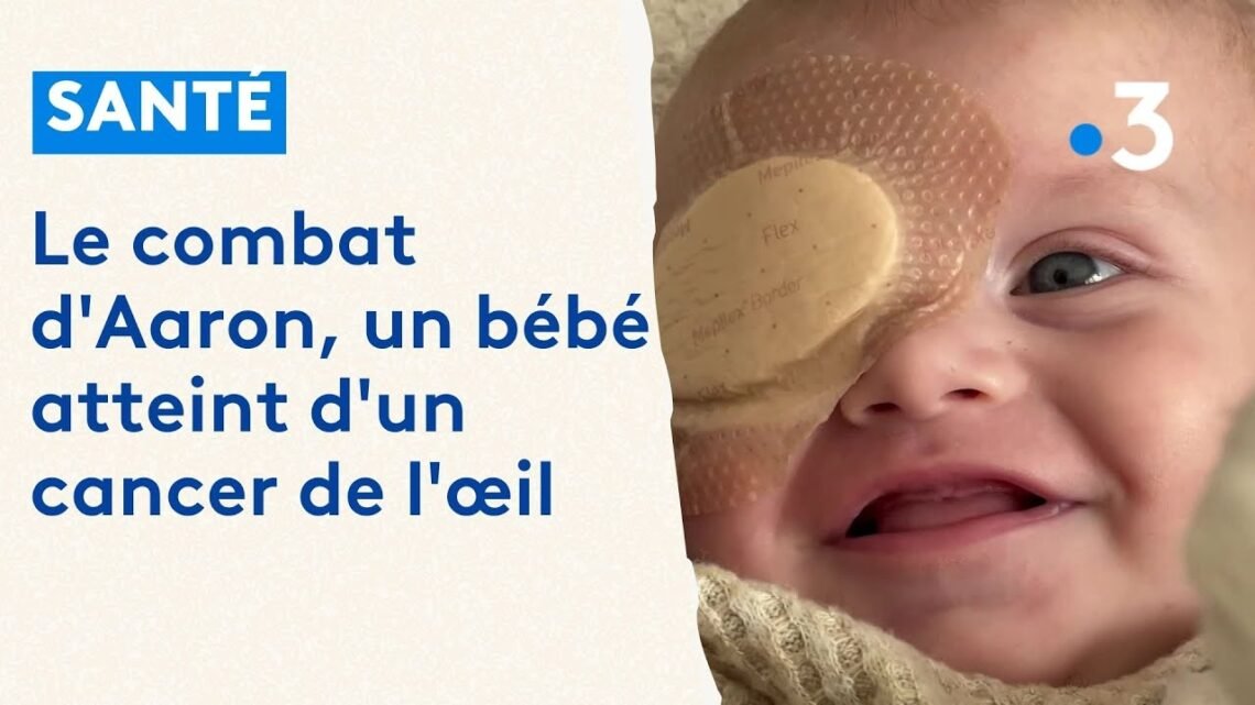 Le combat de bébé Aaron contre le cancer de l’œil Le combat de bébé Aaron contre le cancer de l’œil