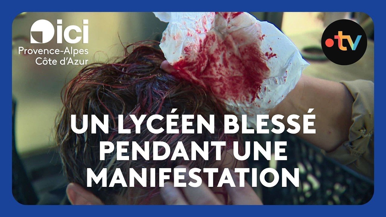 Témoignage d&rsquo;un lycéen blessé durant une manifestation à Marseille
