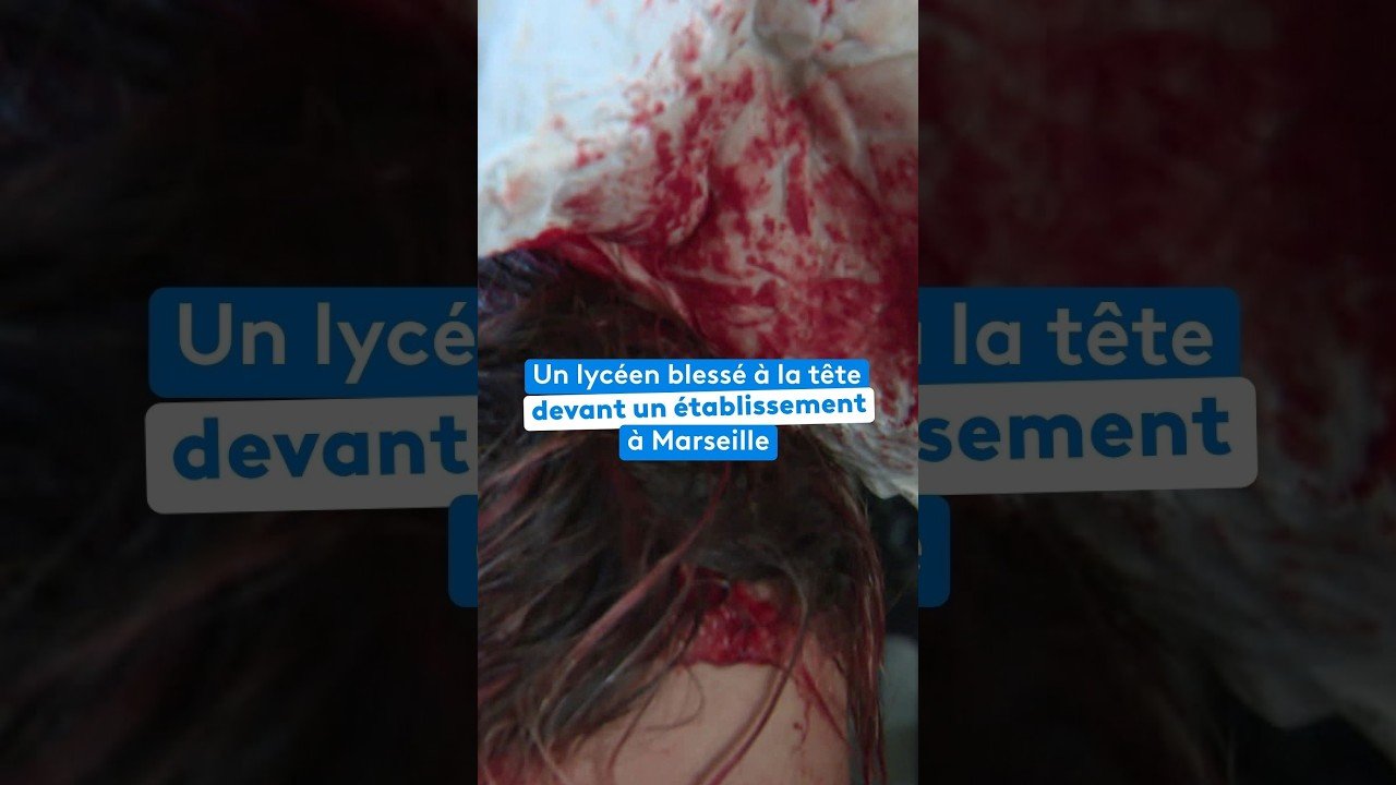 Un lycéen blessé à la tête devant un établissement à Marseille